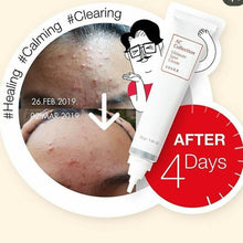 Load image into Gallery viewer, CosRx AC Collection Ultimate Spot Cream