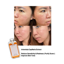 Load image into Gallery viewer, One Thing Artemisia Capillaris Extract