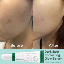 Load image into Gallery viewer, Axis-Y Dark Spot Correcting Glow Serum
