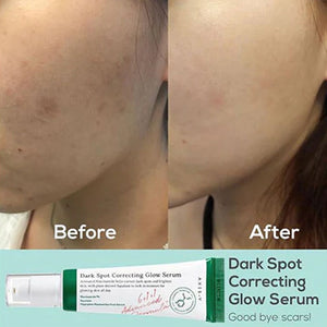 Axis-Y Dark Spot Correcting Glow Serum